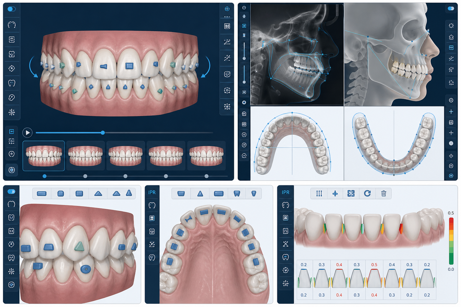 Clear aligners with generic digital planning visualization